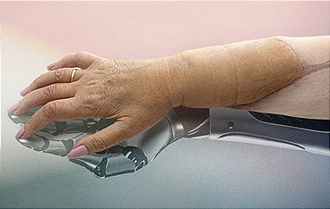 Die neue Hand - Geschichte einer Transplantation